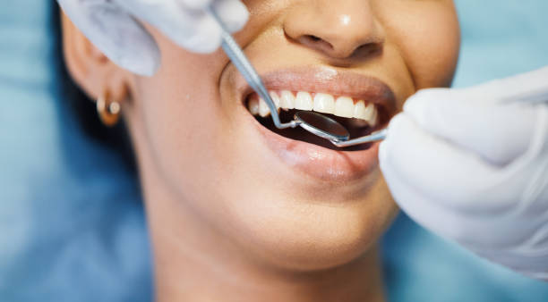 Best Same-Day Emergency Dentist in Maquoketa, IA