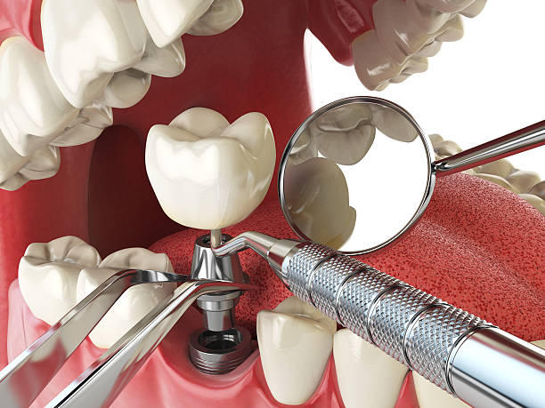 Best Weekend Emergency Dentist in Maquoketa, IA